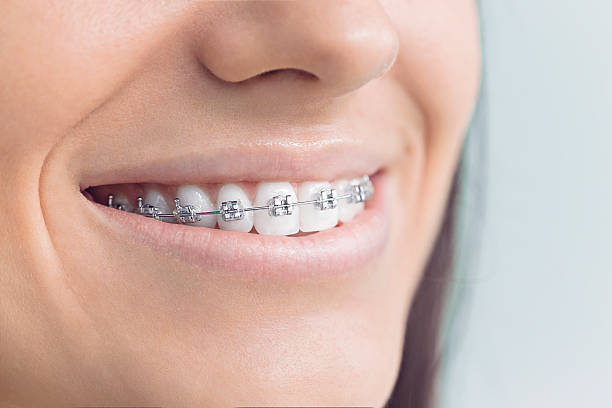 Best Veneers and Lumineers  in Atascocita, TX